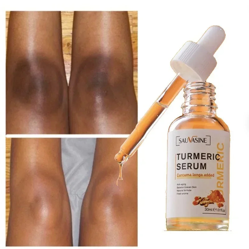 Turmeric Face Skin Care Set - DigitalDealHeaven DigitalDealHeaven